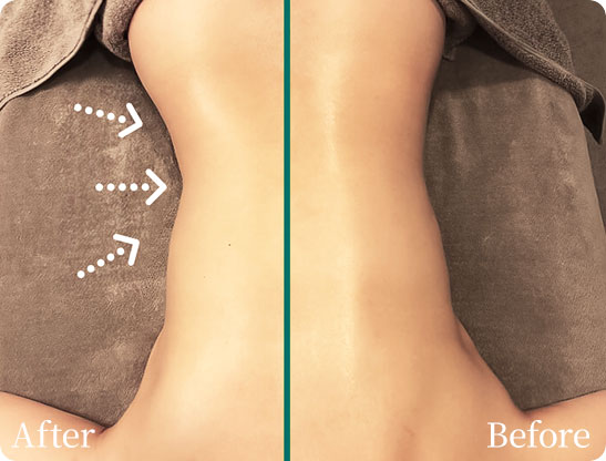 パワーレメディ Before／After 施術症例　背中・腰回り