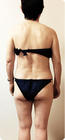 パワーレメディ Before／After 施術症例　60代　1回施術