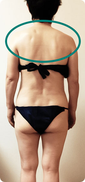 パワーレメディ Before／After 施術症例　60代　1回施術