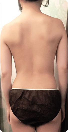 パワーレメディ Before／After 施術症例　30代　5回施術