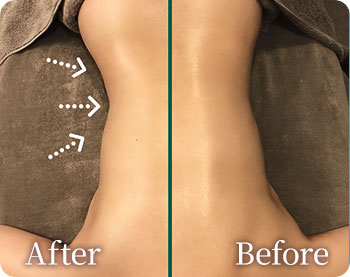 パワーレメディ 背中・腰回り 左側を施術 /1回10分の結果です